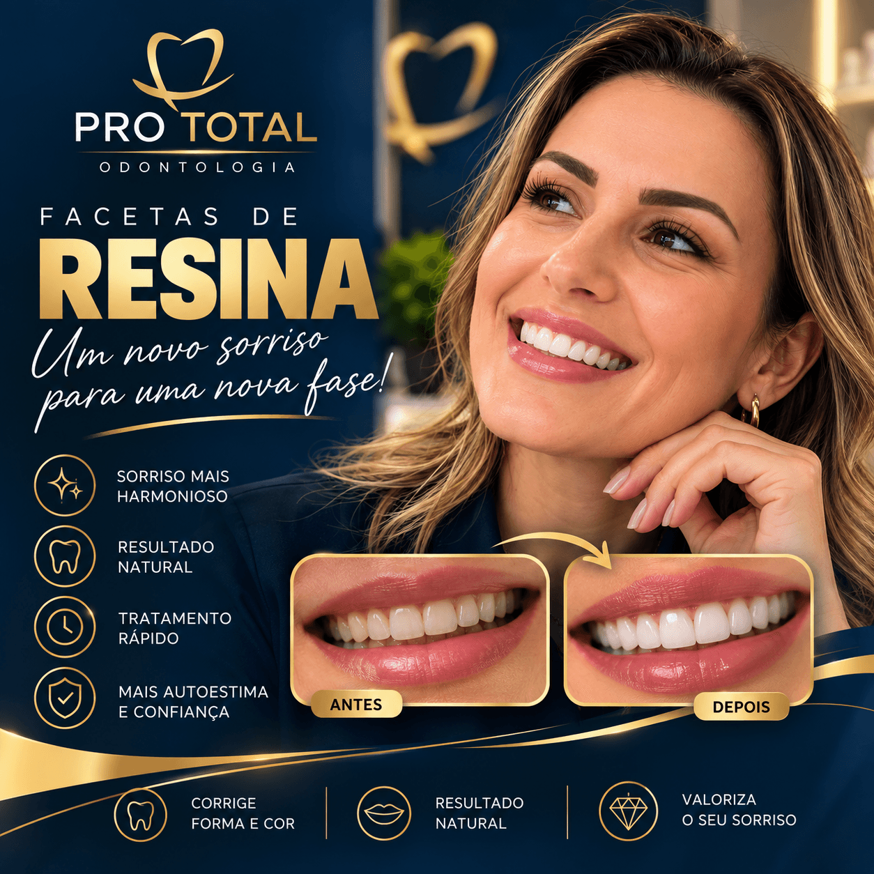Facetas de resina: harmonia, naturalidade e um novo sorriso feito especialmente para você.