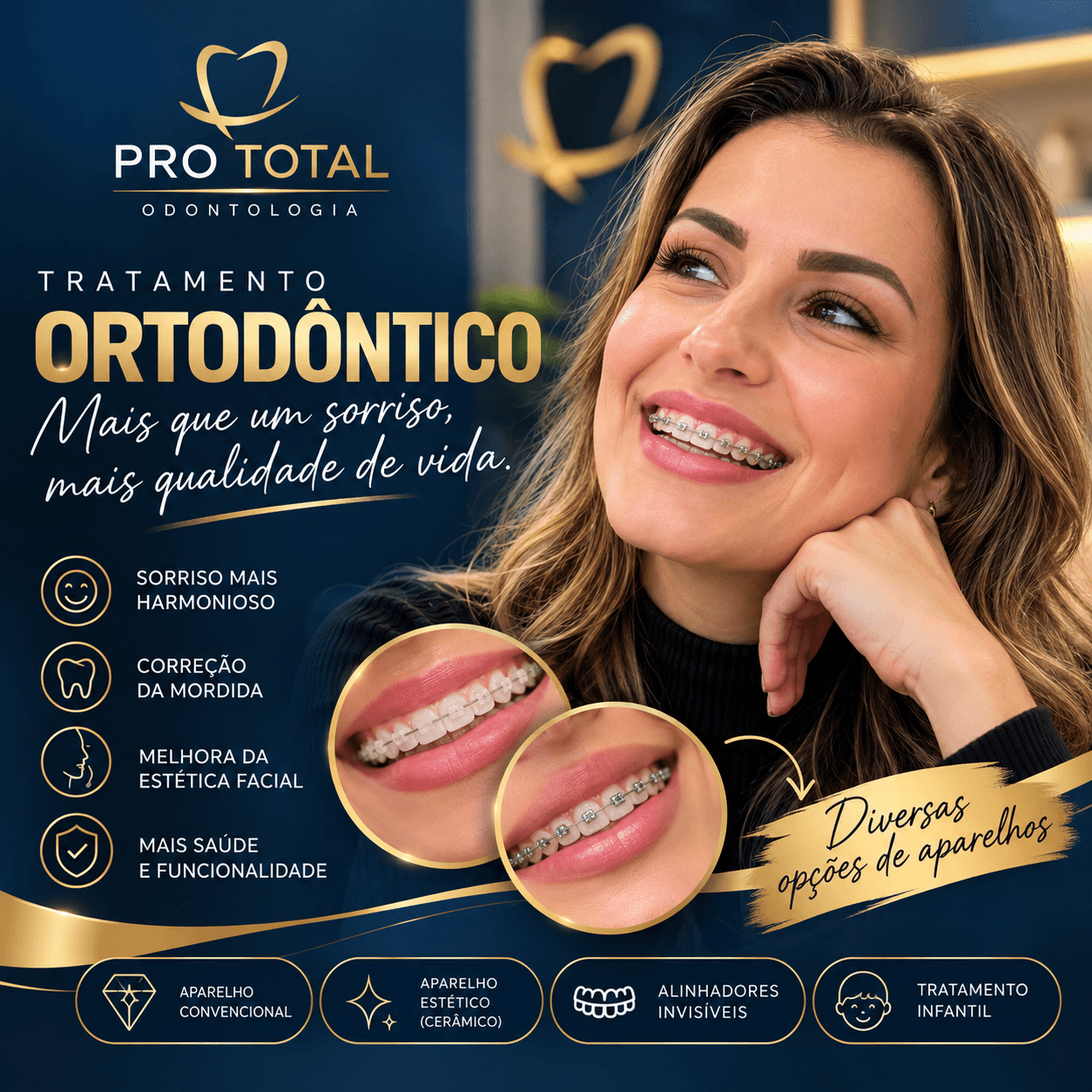 “Aparelho ortodôntico: alinhando seu sorriso para unir estética, saúde e funcionalidade em cada etapa do tratamento.”